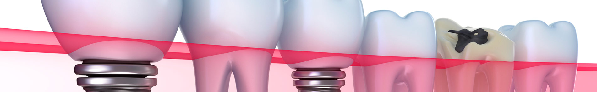 Dentista en Sant Boi