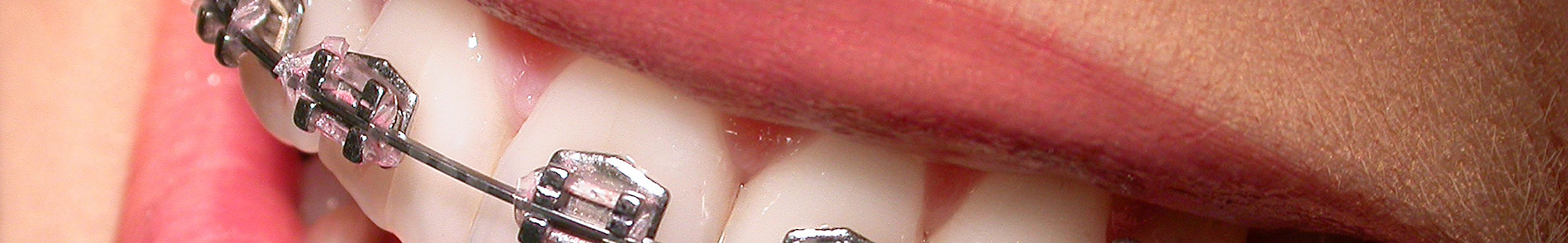 Clínica dental Gava