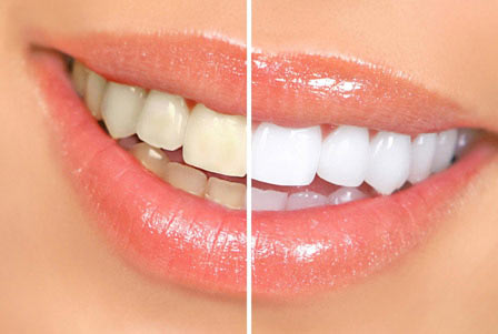 estética dental 