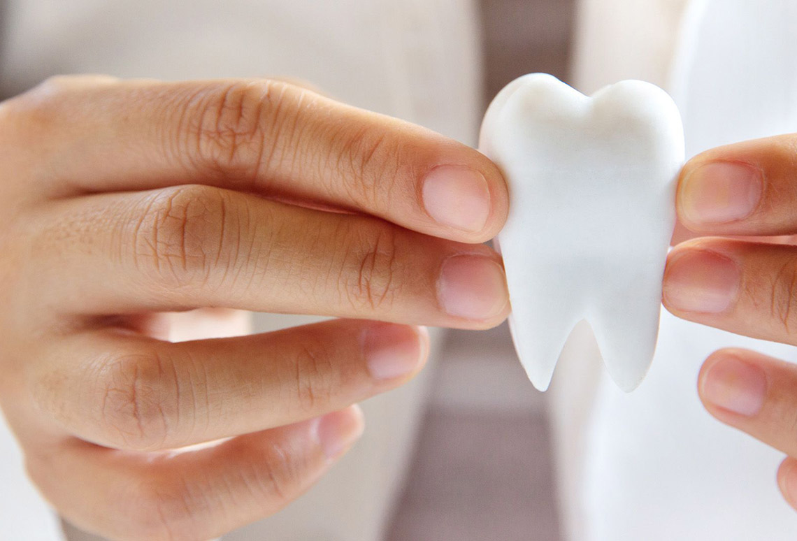 implants dentals