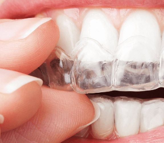 Dentista Viladecans